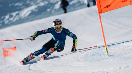 Alice Merryweather Suffers Leg Break